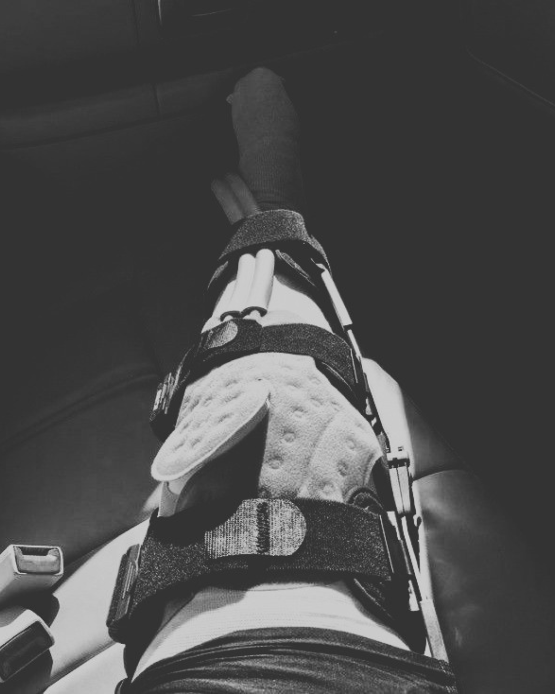 I Got Injured...